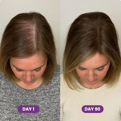 Hair Growth Accelerator Soft Chews